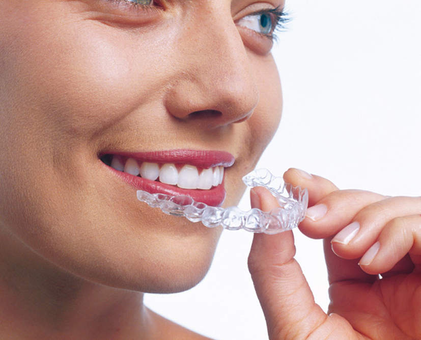 Invisalign